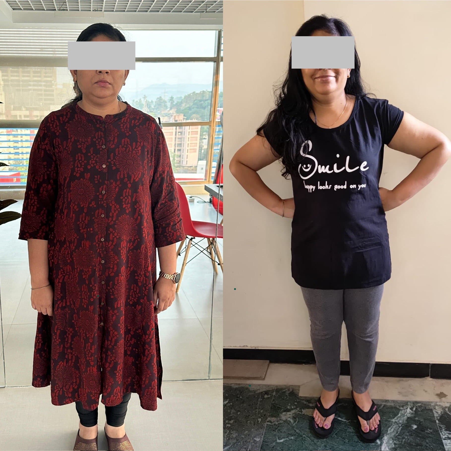 RJ transformation